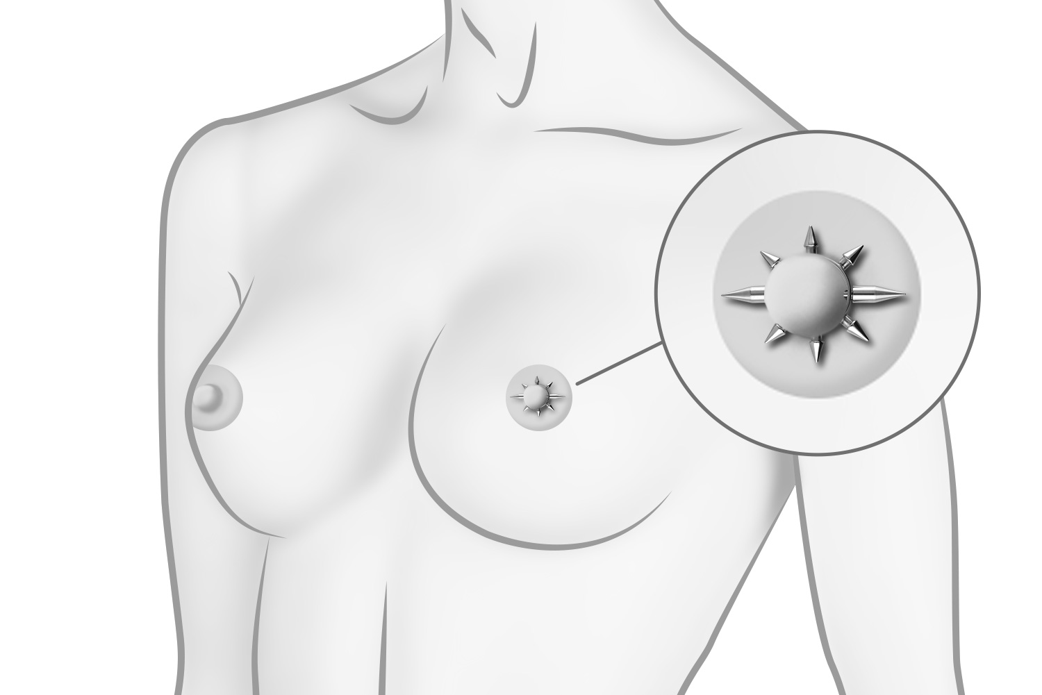 Surgical steel nipple ring CONES