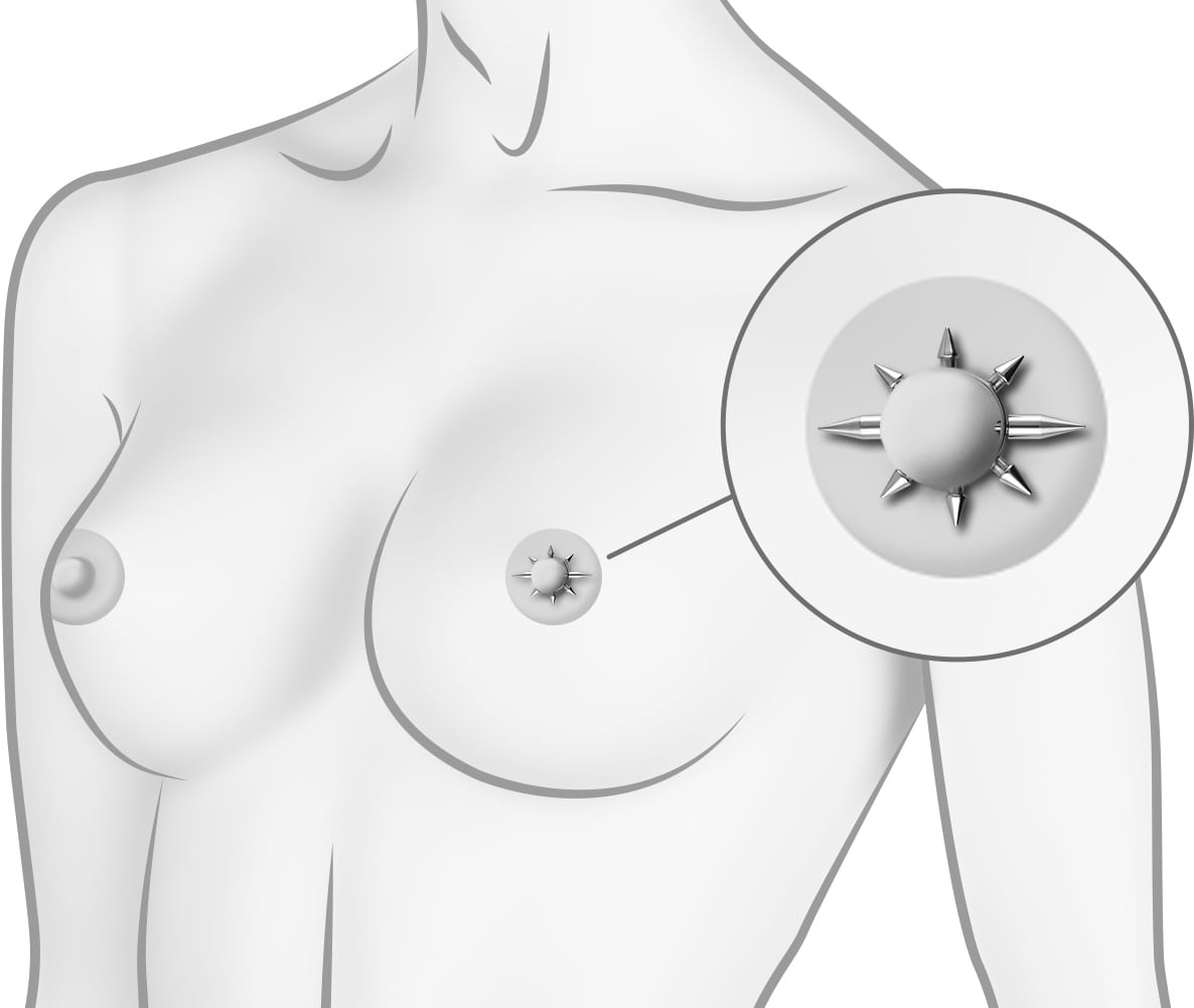 Surgical steel nipple ring CONES